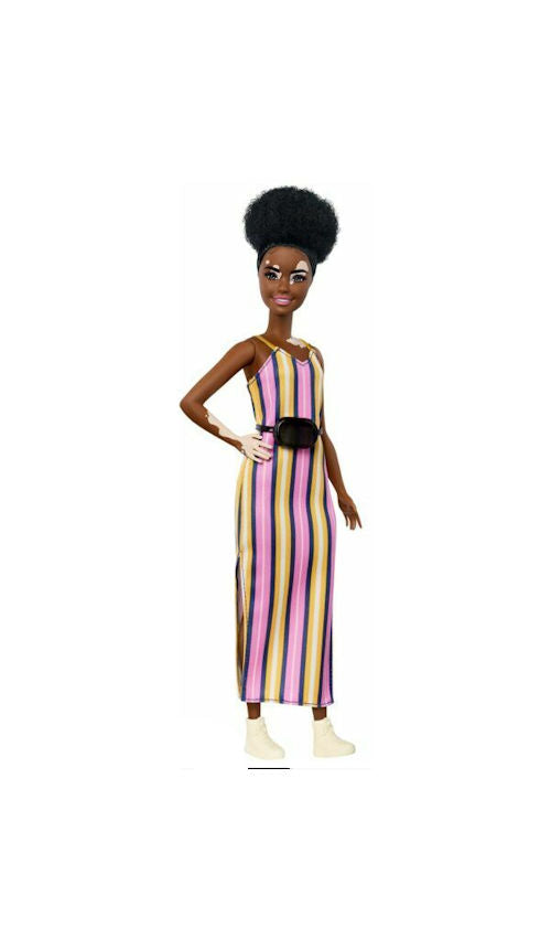 Barbie Fashionistas Doll Vitiligo & Curly Brunette Hair Wearing Striped Dress